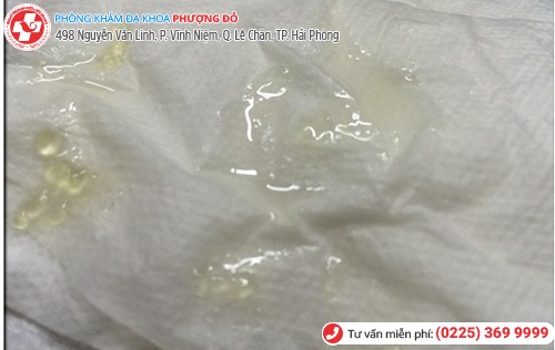 nguyên nhân tinh trùng màu vàng