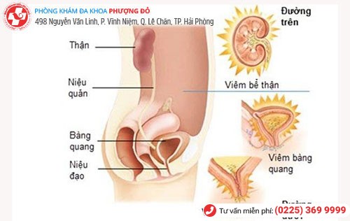 Nhiễm trùng đường tiểu khiến bệnh nhân đi tiểu không được Nhiễm trùng đường tiểu khiến bệnh nhân đi tiểu không được
