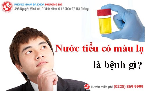 Nước tiểu có màu lạ - Dấu hiệu của nhiều bệnh lý nguy hiểm