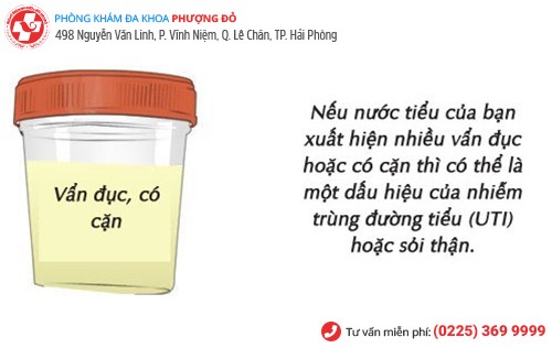 Nước tiểu vẩn đục, có cặn Nước tiểu vẩn đục, có cặn