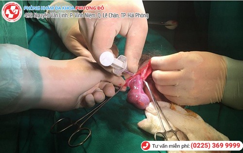 chữa trị xoắn tinh hoàn