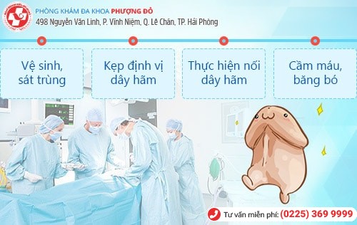 Nên cắt dây hãm quy đầu khi nào? Giải đáp chi tiết bác sĩ chuyên khoa