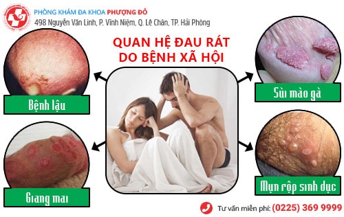 quan hệ đau rát nam quan hệ đau rát nam