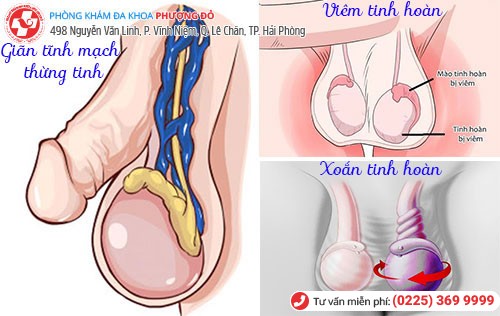 Các bệnh gây sa tinh hoàn Các bệnh gây sa tinh hoàn