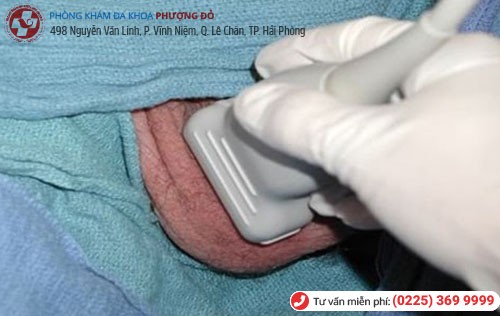 Hình ảnh siêu âm tinh hoàn Hình ảnh siêu âm tinh hoàn