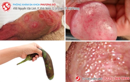 chữa yếu sinh lý tại nhà