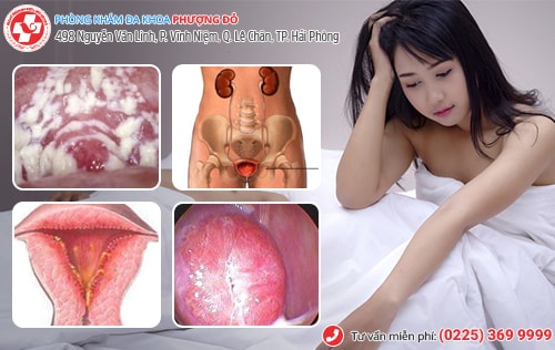 Tiểu buốt sau quan hệ ở nam, nữ do đâu? Có sao không? Tiểu buốt sau quan hệ ở nam, nữ do đâu? Có sao không?