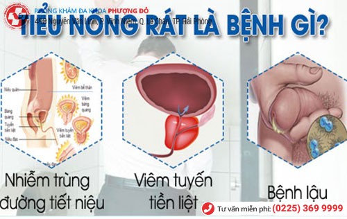 Tiểu nóng rát là dấu hiệu nhiều bệnh nguy hiểm Tiểu nóng rát là dấu hiệu nhiều bệnh nguy hiểm