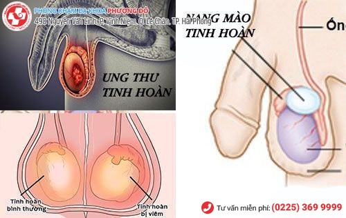 tinh hoàn khó chịu