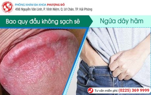 Ngứa dây hãm bao quy đầu là bệnh gì? Ngứa dây hãm bao quy đầu là bệnh gì?