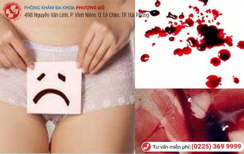 Chảy máu âm đạo bất thường là dấu hiệu nhiều bệnh nguy hiểm Chảy máu âm đạo bất thường là dấu hiệu nhiều bệnh nguy hiểm