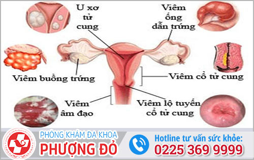 Những Bệnh Phụ Khoa Nguy Hiểm Cần Gặp Bác Sĩ
