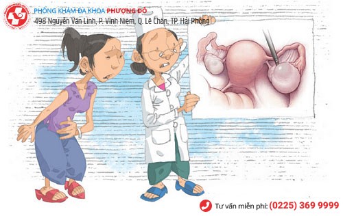 Viêm buồng trứng là bệnh lí nguy hiểm Biến chứng viêm buồng trứng