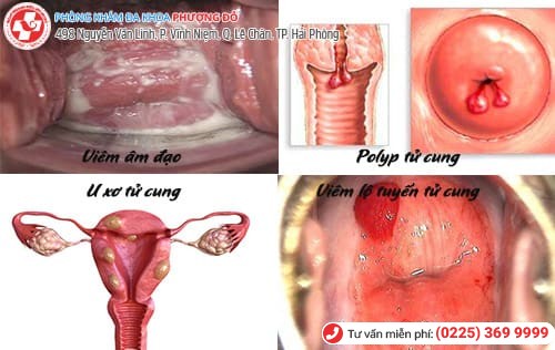 các bệnh vùng kín các bệnh vùng kín