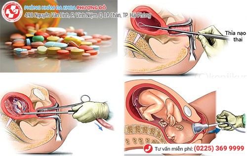 1 số phương pháp phá thai an toàn tại Phòng Khám Phượng Đỏ hiện nay 1 số phương pháp phá thai an toàn tại Phòng Khám Phượng Đỏ hiện nay