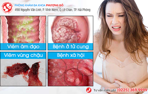 Chảy máu vùng kín