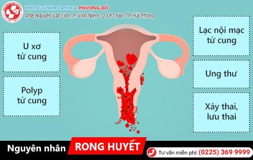 Chị em cần hiểu đúng về hiện tượng rong huyết Chị em cần hiểu đúng về hiện tượng rong huyết