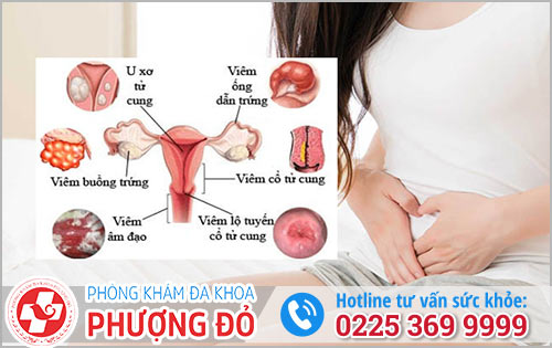 Chị Em Nên Cẩn Trọng Với Những Bệnh Phụ Khoa Nguy Hiểm Sau