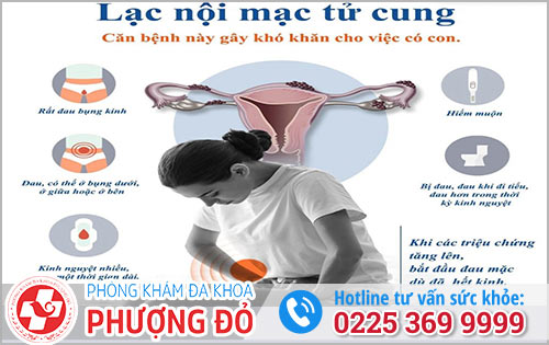 Lạc nội mạc tử cung có thể điều trị bằng thuốc để giảm triệu chứng