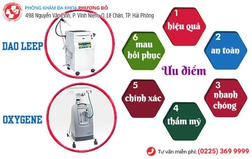 Phương pháp Oxygen O3, dao LEEP chữa rối loạn kinh nguyệt hiệu quả Phương pháp Oxygen O3, dao LEEP chữa rối loạn kinh nguyệt hiệu quả