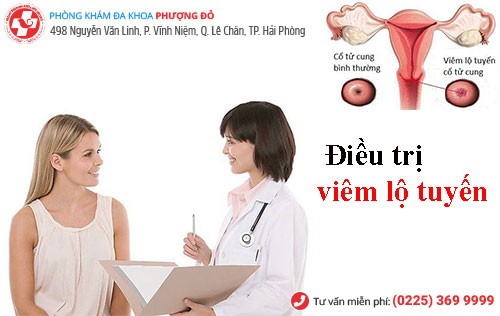Điều trị viêm lộ tuyến sớm chính là cách bảo vệ thiên chức làm mẹ