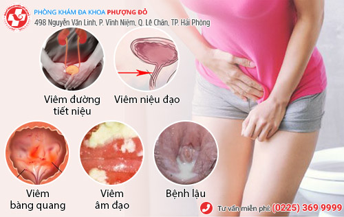 đái buốt ở nữ đái buốt ở nữ