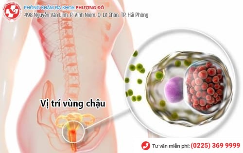 Đau bụng dưới là bị bệnh gì?