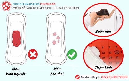 11 dấu hiệu nhận biết có thai sớm nhất chị em nên lưu ý