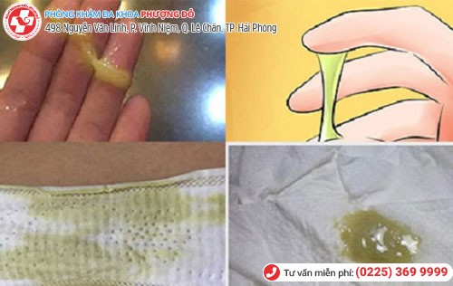 Hình ảnh ra nhiều khí hư màu xanh Hình ảnh ra nhiều khí hư màu xanh