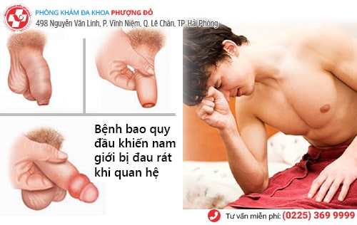 Đau rát vùng kín khi quan hệ ở nam và nữ, dấu hiệu nhiều bệnh nguy hiểm