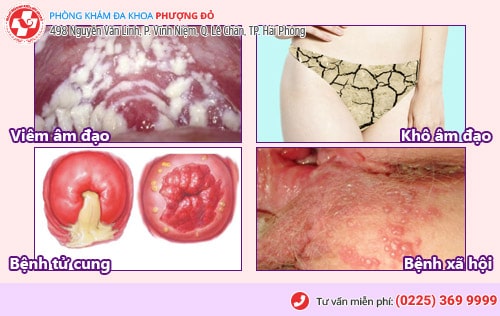Đau rát vùng kín khi quan hệ ở nam và nữ, dấu hiệu nhiều bệnh nguy hiểm