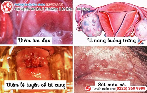 Đau rát vùng kín thì là bệnh gì? Đau rát vùng kín thì là bệnh gì?