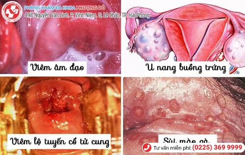 đau rát vùng kín đau rát vùng kín