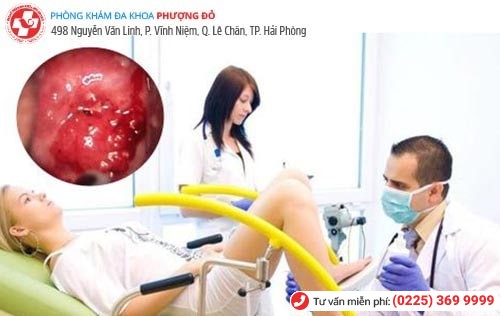 Đốt viêm lộ tuyến - 1 phương pháp được áp dụng nhiều hiện nay Đốt viêm lộ tuyến - 1 phương pháp được áp dụng nhiều hiện nay