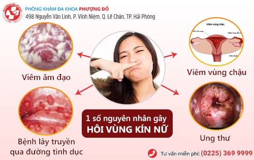hôi vùng kín