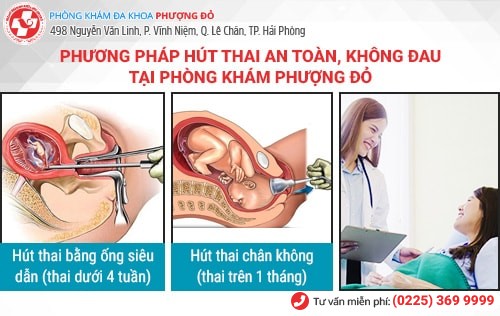 Phương pháp hút thai không đau Phương pháp hút thai không đau