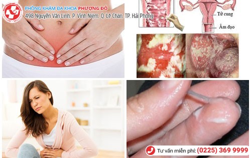 Các triệu chứng cơ bản khi nhiễm nấm Các triệu chứng cơ bản khi nhiễm nấm