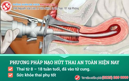 Nạo hút thai có nguy hiểm không? Địa chỉ phá thai an toàn ở Hải Phòng Nạo hút thai có nguy hiểm không? Địa chỉ phá thai an toàn ở Hải Phòng