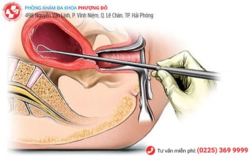 Nạo hút thai cần thực hiện ở các cơ sở y tế đảm bảo phòng tránh biến chứng Nạo hút thai cần thực hiện ở các cơ sở y tế đảm bảo phòng tránh biến chứng