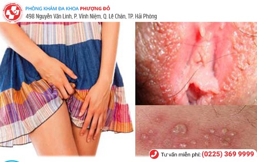 Ngứa phụ khoa do nhiều nguyên nhân gây nên Ngứa phụ khoa do nhiều nguyên nhân gây nên