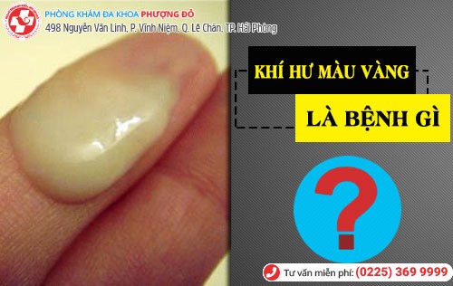 Khí hư màu vàng là bệnh viêm cổ tử cung Khí hư màu vàng là bệnh gì?