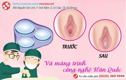 Nguyên nhân làm rách màng trinh chị em cần biết Nguyên nhân làm rách màng trinh chị em cần biết