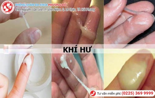 biểu hiện nấm âm đạo biểu hiện nấm âm đạo