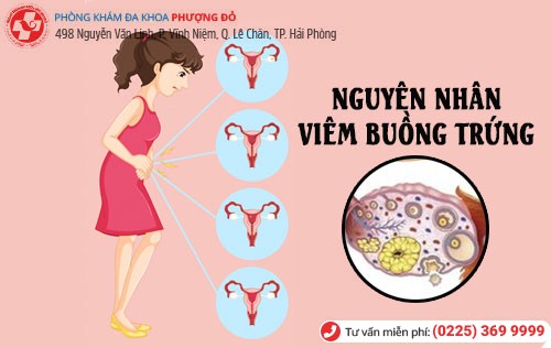 Nguyên nhân viêm buồng trứng Viêm buồng trứng