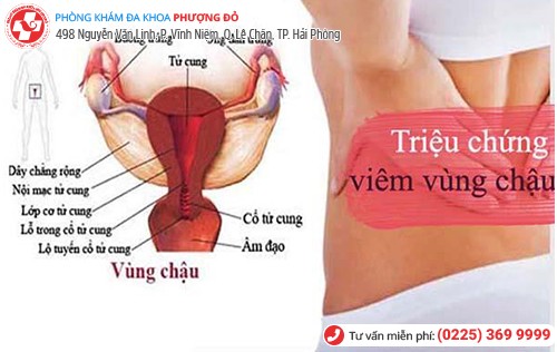 Nhận biết nhanh các dấu hiệu viêm vùng chậu nữ