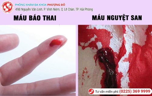 Phân biết máu báo thai và máu nguyệt san