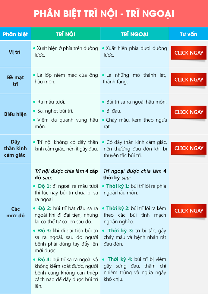 Cách phân biệt trĩ nội trĩ ngoại đơn giản, chính xác nhất Cách phân biệt trĩ nội trĩ ngoại đơn giản, chính xác nhất