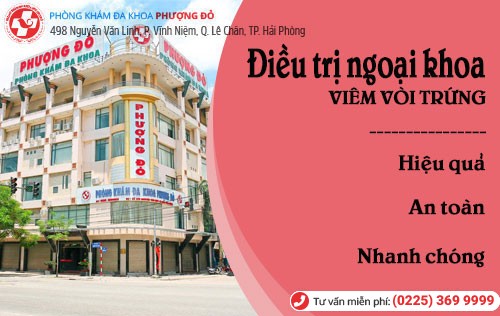 Điều trị viêm vòi trứng Phương pháp điều trị viêm vòi trứng