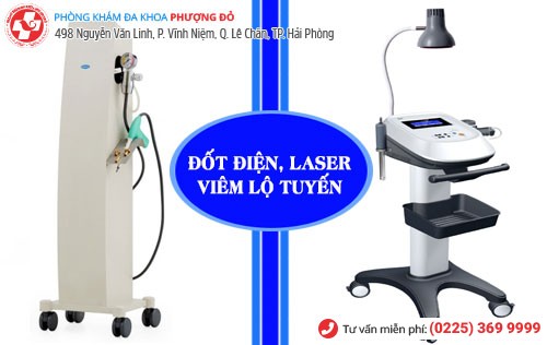 Phương pháp đốt điện, đốt laser viêm lộ tuyến Phương pháp đốt viêm lộ tuyến