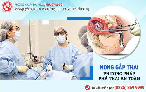 Phương pháp nong gắp thai Phương pháp nong gắp thai